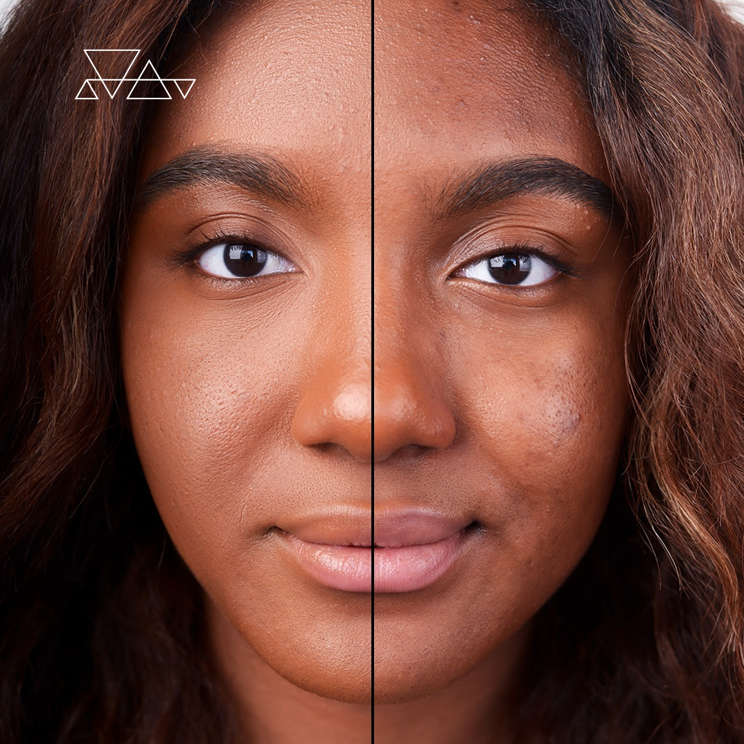 GOOD coverage<br> for all your skin concerns